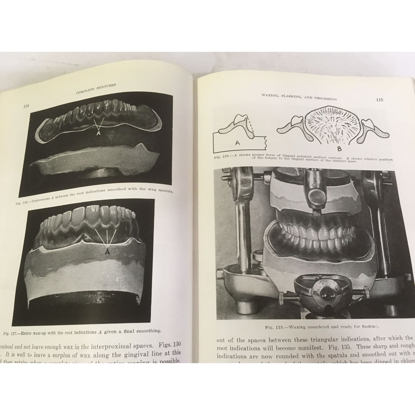 Complete Dentures - Merril G. Swenson, D.D.S. - ©1941