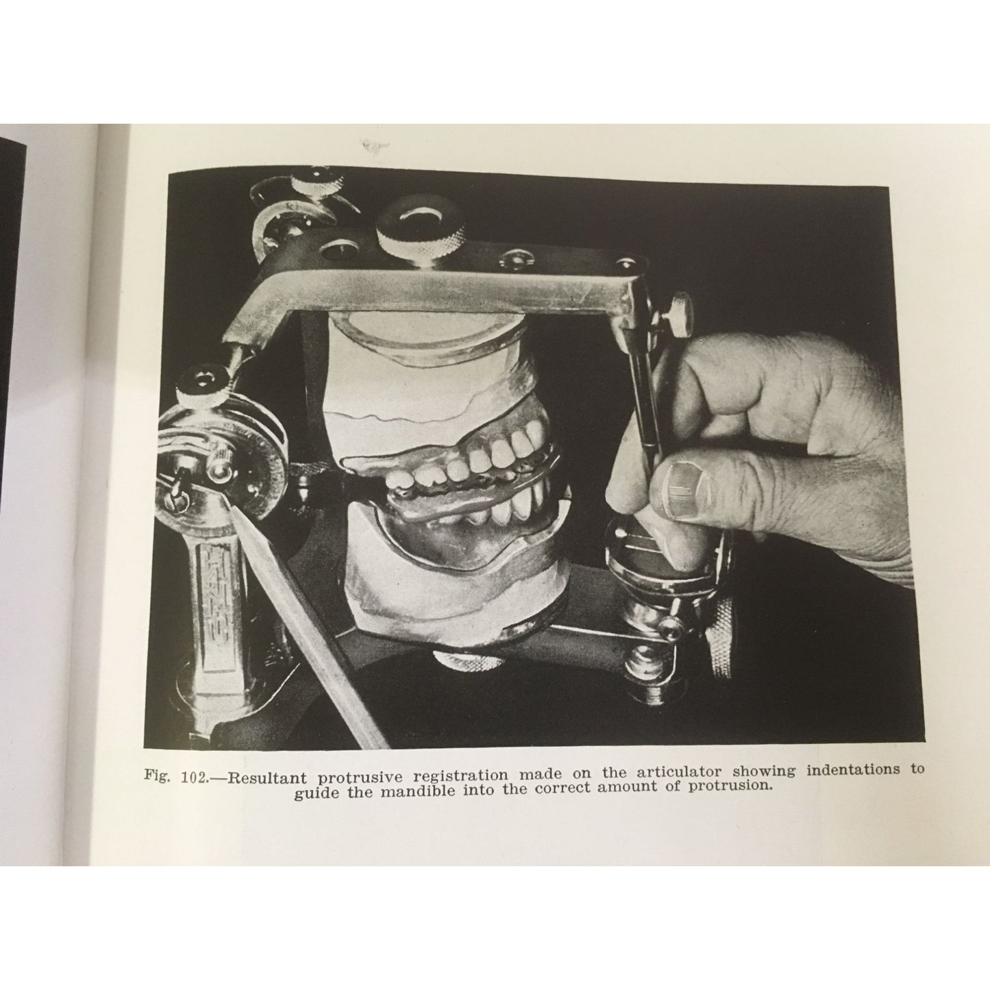 Complete Dentures - Merril G. Swenson, D.D.S. - ©1941